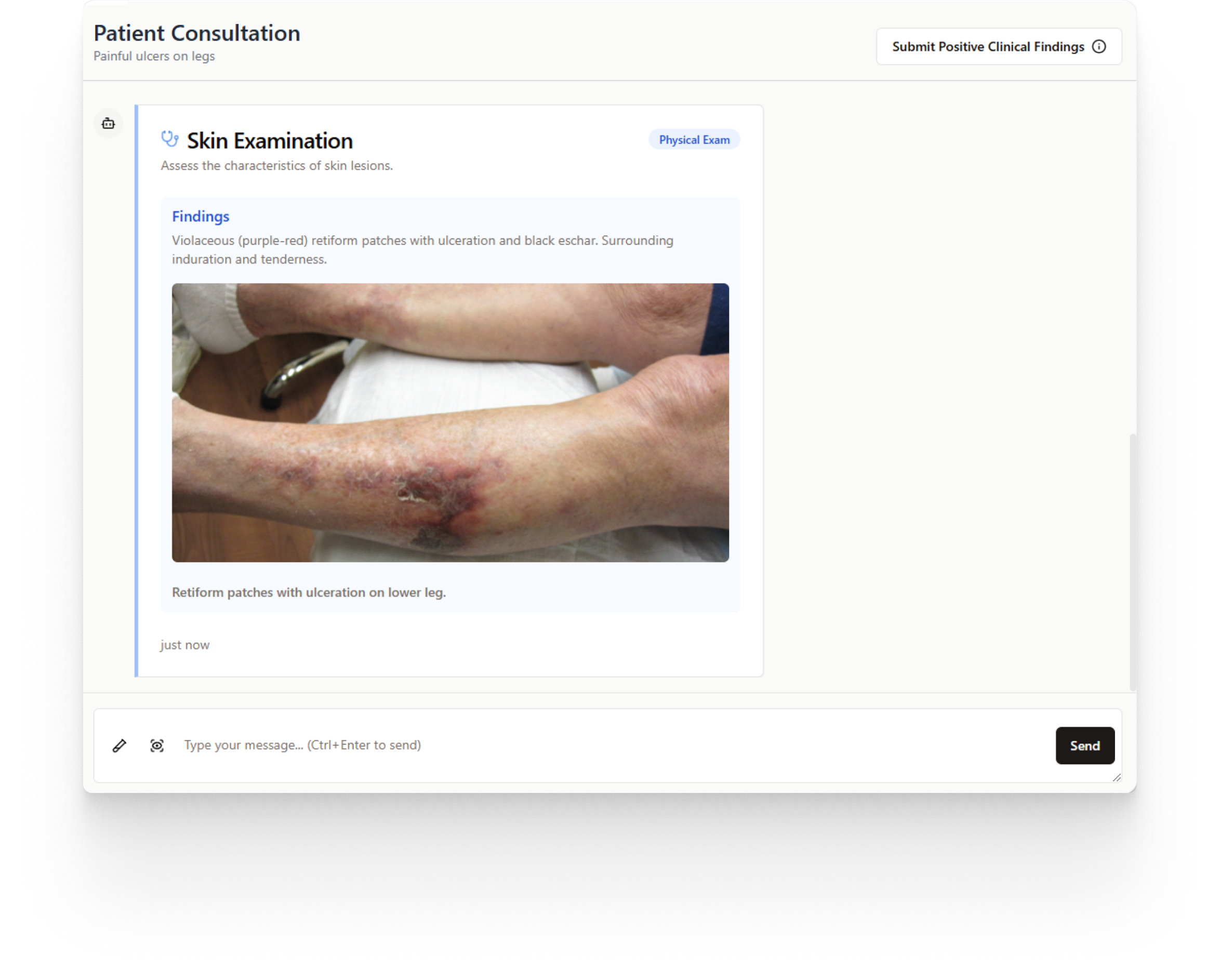 A skin examination in the consultation: the findings written out above a clinical photograph of the patient's lower leg.