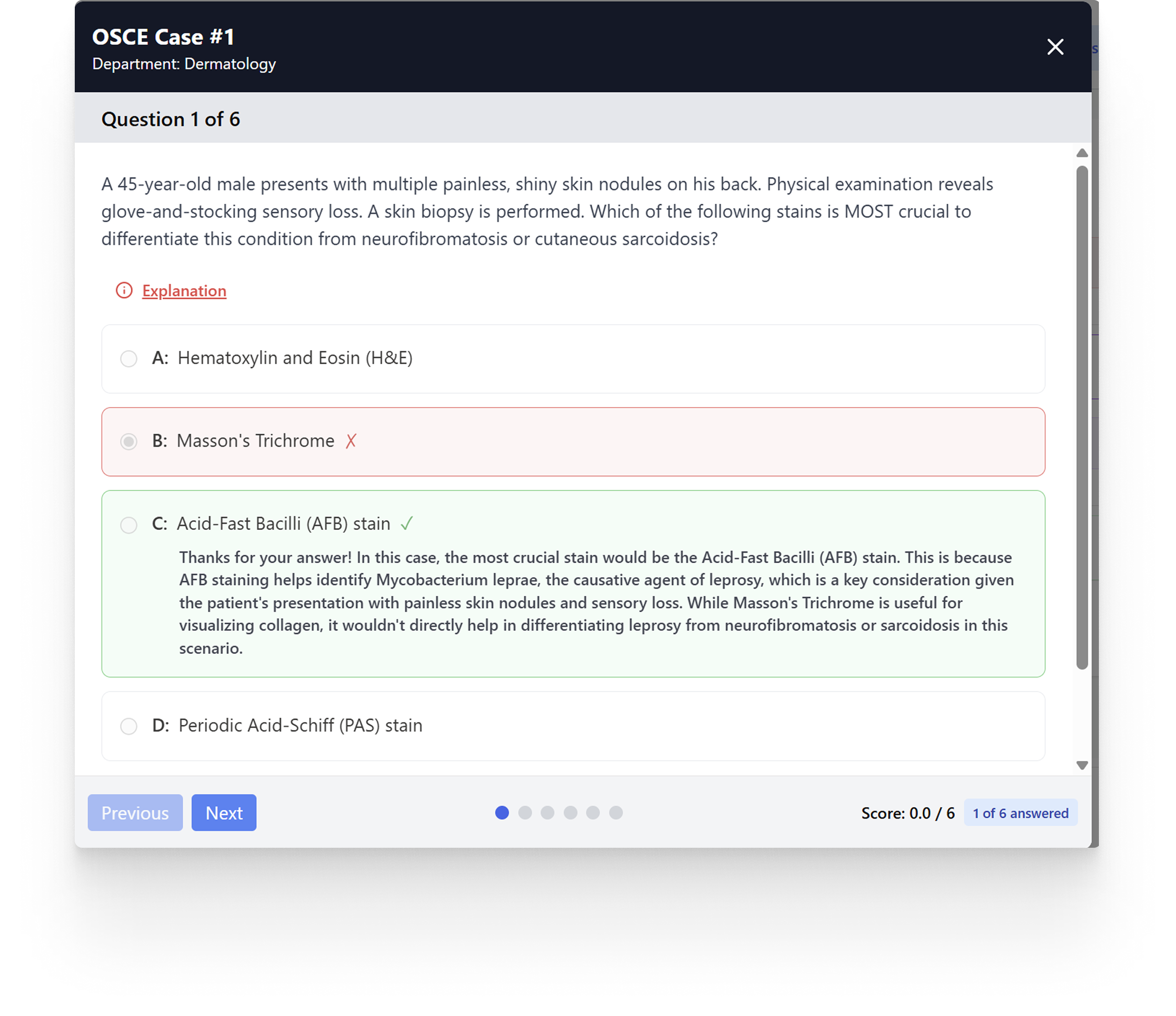 An OSCE question with four stain options, the chosen answer marked wrong and the correct one expanded with an explanation.