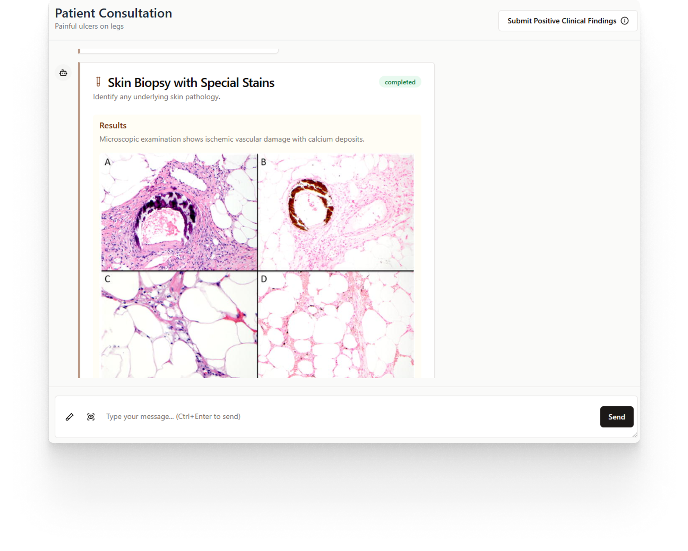 A completed skin biopsy: the result written out above four stained slides labelled A to D.